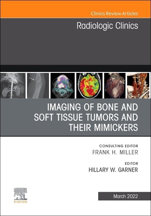 Physiotherapy & Medical Books > Imaging of Bone and Soft Tissue Tumors ...