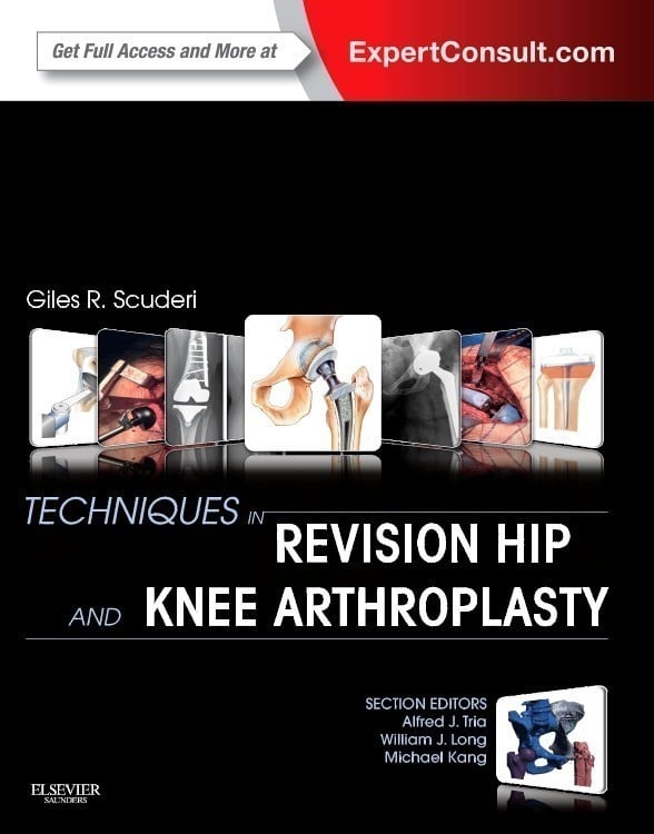 Physiotherapy & Medical Books > Techniques in Revision Hip and Knee