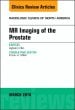 MR Imaging of the Prostate, An Issue of Radiologic Clinics of North America