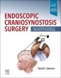 Endoscopic Craniosynostosis Surgery