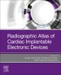 Radiographic Atlas of Cardiac Implantable Electronic Devices