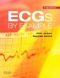 ECGs by Example. Edition: 3
