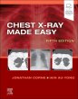 Chest X-Ray Made Easy. Edition: 5