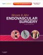 Endovascular Surgery. Edition: 4