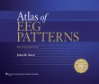 Atlas of EEG Patterns. Edition Second