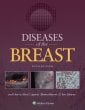 Diseases of the Breast 5e. Edition Fifth
