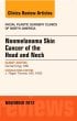 Nonmelanoma Skin Cancer of the Head and Neck, An Issue of Facial Plastic Surgery Clinics