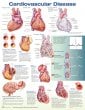 Cardiovascular Disease Anatomical Chart. Edition Third