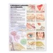 Understanding Allergies Anatomical Chart. Edition Second