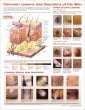 Common Lesions and Disorders of the Skin Anatomical Chart. Edition Third