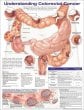Understanding Colorectal  Cancer Anatomical Chart. Edition Second