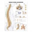 Human Spine Disorders Anatomical Chart. Edition Second