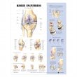 Knee Injuries Anatomical Chart