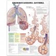 Understanding Asthma Anatomical Chart. Edition Second