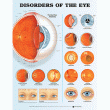 Disorders of the Eye Anatomical Chart. Edition Second