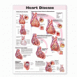 Heart Disease Anatomical Chart. Edition Second