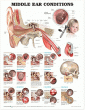 Middle Ear Conditions Anatomical Chart . Edition Second