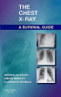 The Chest X-Ray: A Survival Guide