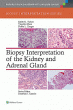 Biopsy Interpretation of the Kidney & Adrenal Gland. Edition First