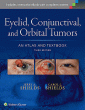 Eyelid, Conjunctival, and Orbital Tumors: An Atlas and Textbook. Edition Third