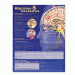 Migraines and Headaches Anatomical Chart, 2nd Edition
