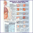 Sexually Transmitted Infections Anatomical Chart. Edition Second