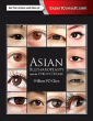Asian Blepharoplasty and the Eyelid Crease. Edition: 3