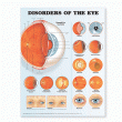 Disorders of the Eye Anatomical Chart. Edition Second