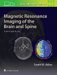 Magnetic Resonance Imaging of the Brain and Spine. Edition Fifth