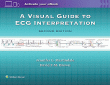 A Visual Guide to ECG Interpretation. Edition Second