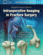 Illustrated Tips and Tricks for Intraoperative Imaging in Fracture Surgery. Edition First