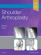 Shoulder Arthroplasty. Edition: 2