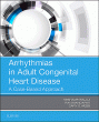 Arrhythmias in Adult Congenital Heart Disease