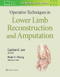 Operative Techniques in Lower Limb  Reconstruction and Amputation