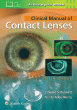 Clinical Manual of Contact Lenses. Edition Fifth