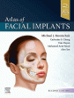 Atlas of Facial Implants. Edition: 2