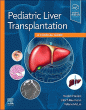 Pediatric Liver Transplantation