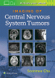 Imaging of Central Nervous System Tumors. Edition First