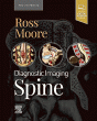 Diagnostic Imaging: Spine. Edition: 4