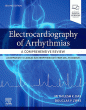 Electrocardiography of Arrhythmias: A Comprehensive Review. Edition: 2