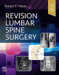 Revision Lumbar Spine Surgery
