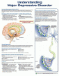 Understanding Major Depressive Disorder. Edition Third