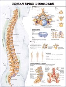 Human Spine Disorders Anatomical Chart. Edition Second