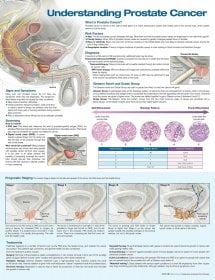 Understanding Prostate Cancer Anatomical Chart. Edition Third