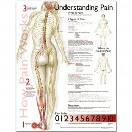Understanding Pain Anatomical Chart