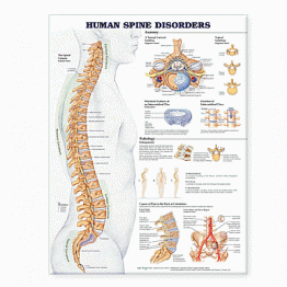 Human Spine Disorders Anatomical Chart. Edition Second