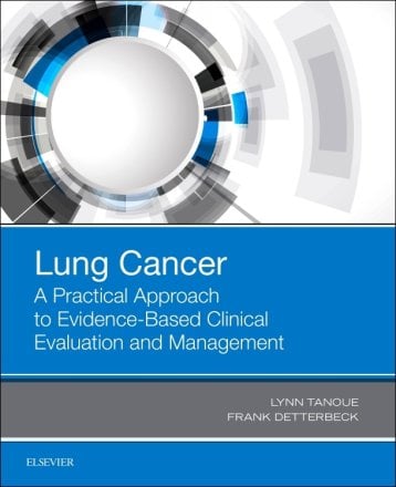 Lung Cancer: A Practical Approach to Evidence-Based Clinical Evaluation and Management