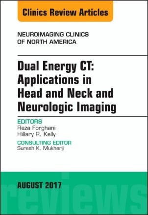 Dual Energy CT: Applications in Head and Neck and Neurologic Imaging, An Issue of Neuroimaging Clinics of North America