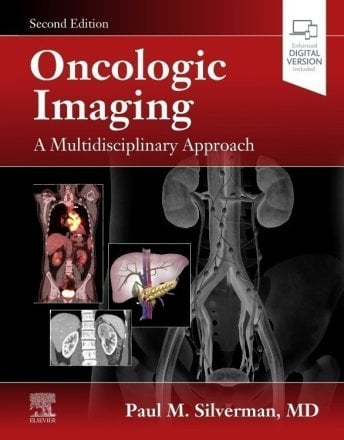 Oncologic Imaging: A Multidisciplinary Approach. Edition: 2