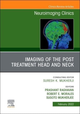 Imaging of the Post Treatment Head and Neck, An Issue of Neuroimaging Clinics of North America